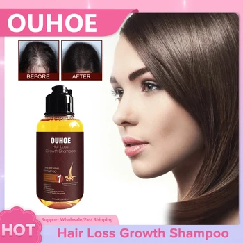 O Crescimento do cabelo Shampoo Anti-queda de Cabelo Espessamento Reparar Danificado Tratamentos de Dispersão de Secagem Ajuda Cabelos de Rebrota, Produtos de Cuidados 100ml